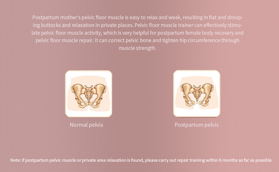 Pelvic Muscle Exercise Trainer - LIONPEACE